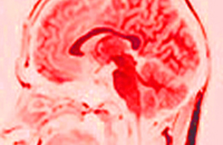 thumbnail background