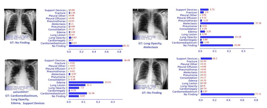 cxr.JPG